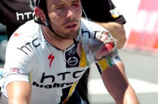Mark Cavendish after the crash. Photo Fotoreporter Sirotti.