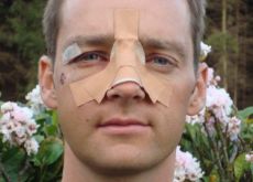 Photo of Team BMC Racing's Karsten Kroon after his surgery.